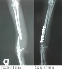 骨折の外科的固定法 | 犬・猫の骨折の治療はおり動物病院